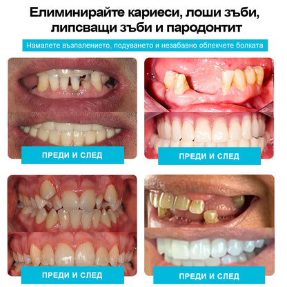 🦷𝑩𝒆𝒂𝒓𝒏𝒊𝒄𝒂™  Комплект протези със силиконова облицовка (⏰Ограничено време за отстъпка, само за 30 минути⏰)